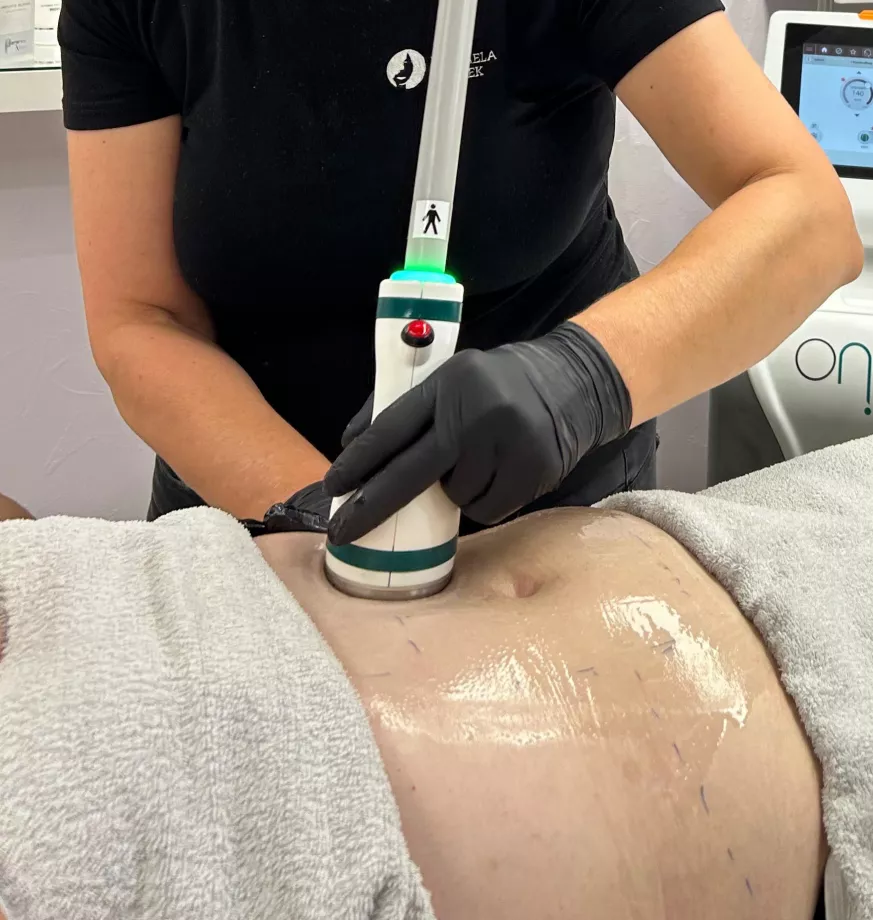 Bodyforming mit Onda Coolwaves™ beim Schöhheitsinstitut Neubrandenburg